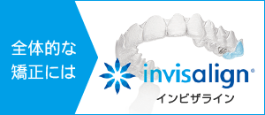 インビザライン