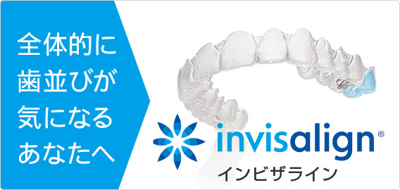 インビザライン